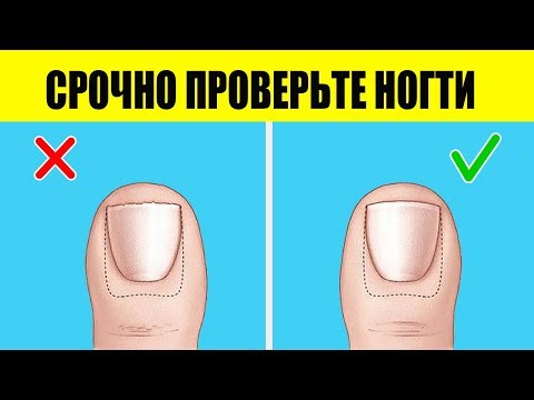 Болезни ногтей с примерами на фото. Часть 2