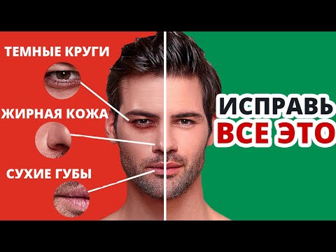 Как Избавиться От Прыщей и Раздражений На Коже (Проблемы с Кожей Лица)