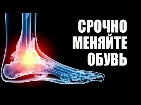 Подагра и Грибок Ногтей. Срочно меняйте Обувь