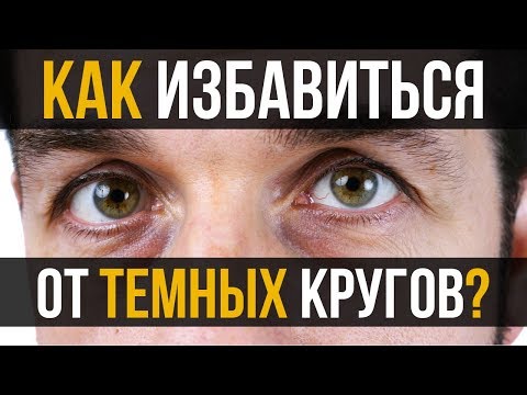 7 советов, как избавиться от темных кругов под глазами